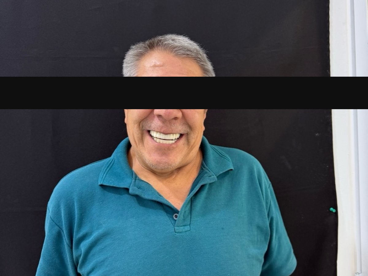 Caso caso-05: imagen después del tratamiento