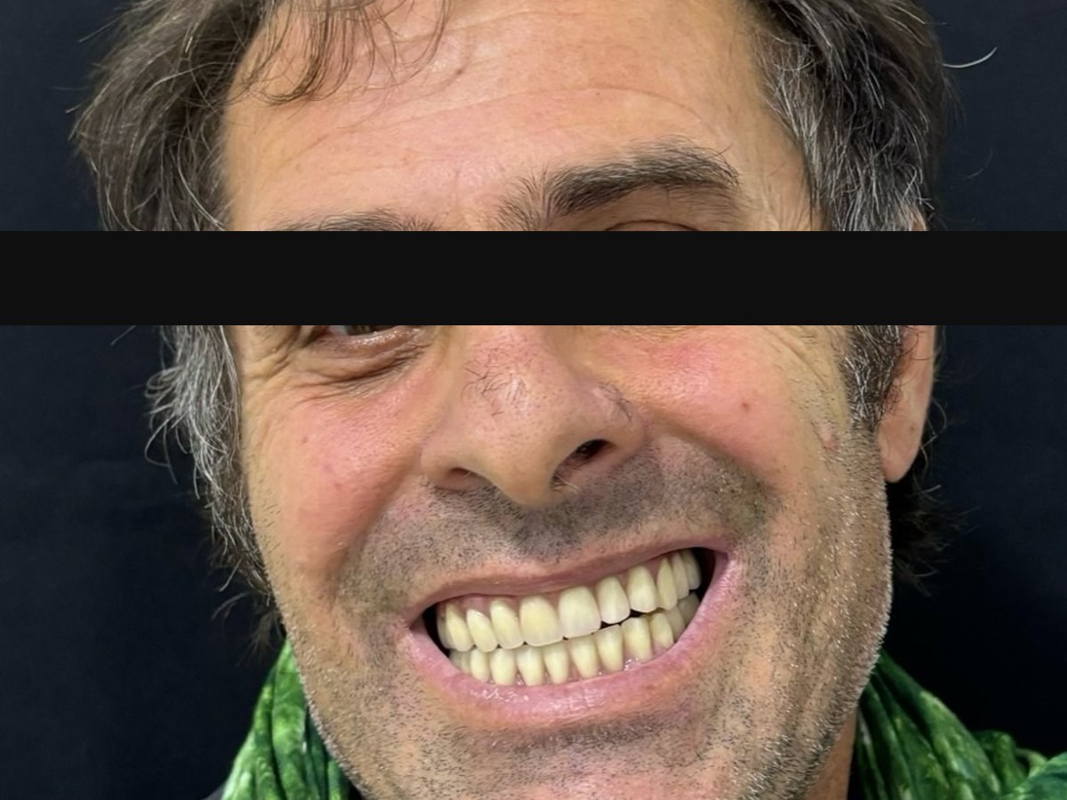 Caso caso-06: imagen después del tratamiento