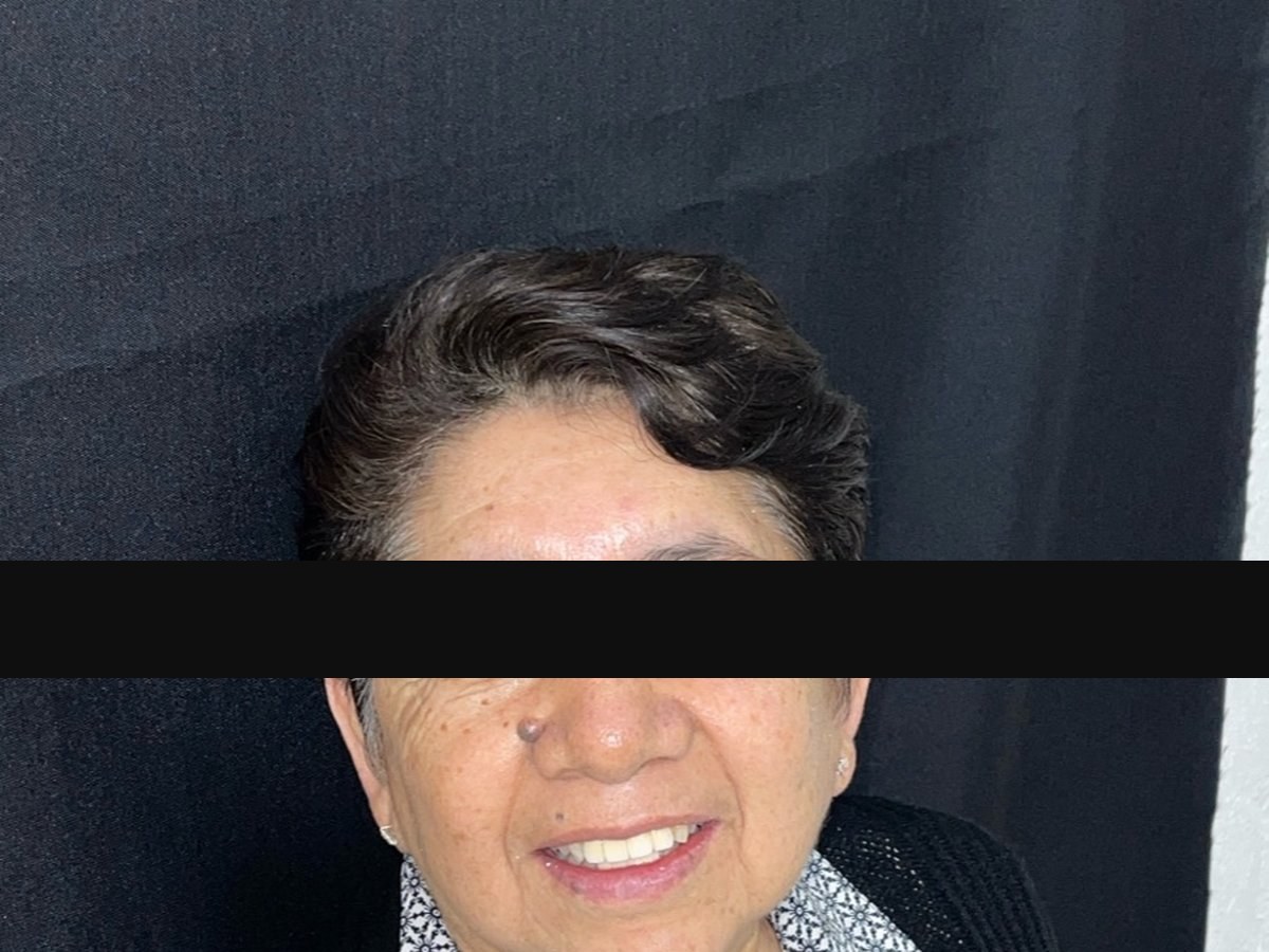 Caso caso-09: imagen después del tratamiento
