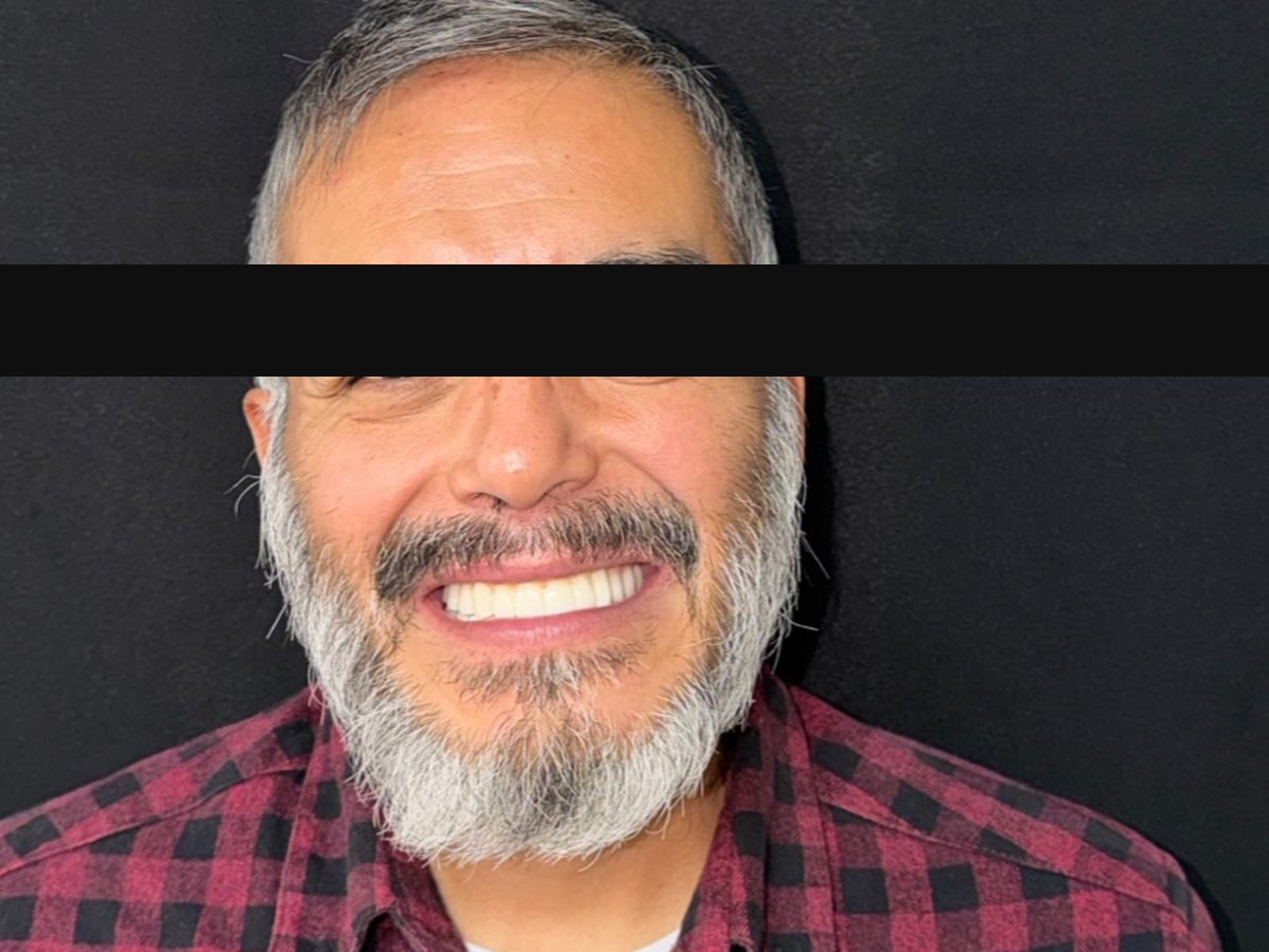 Caso caso-12: imagen después del tratamiento